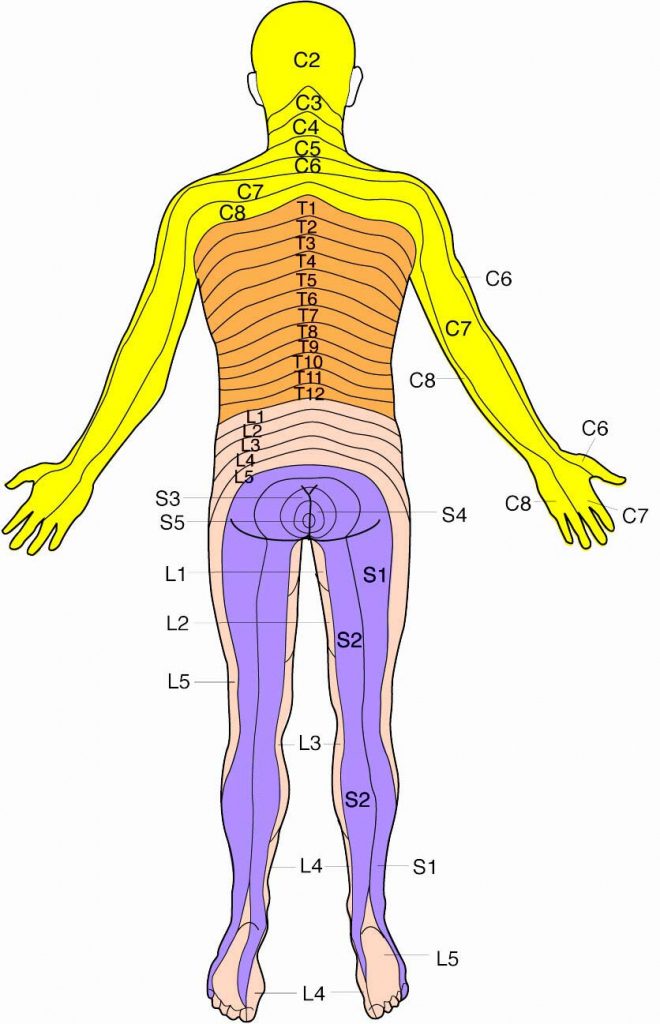 Dermatomes Map (89+ Images In Collection) Page 3 - Printable Dermatome ...